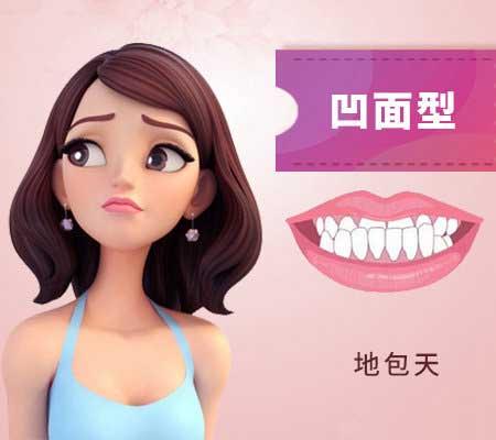 什么是地包天？地包天長(zhǎng)什么樣子？地包天牙齒圖片