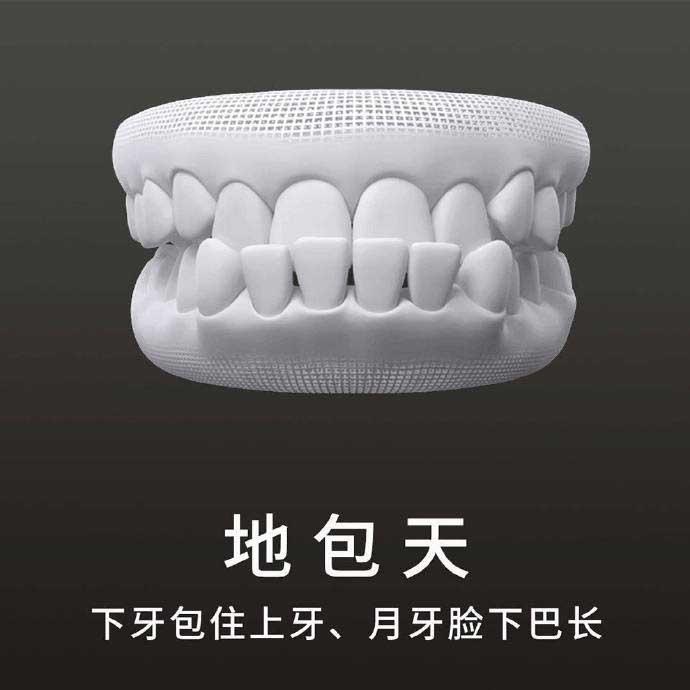 什么是地包天？地包天長(zhǎng)什么樣子？地包天牙齒圖片